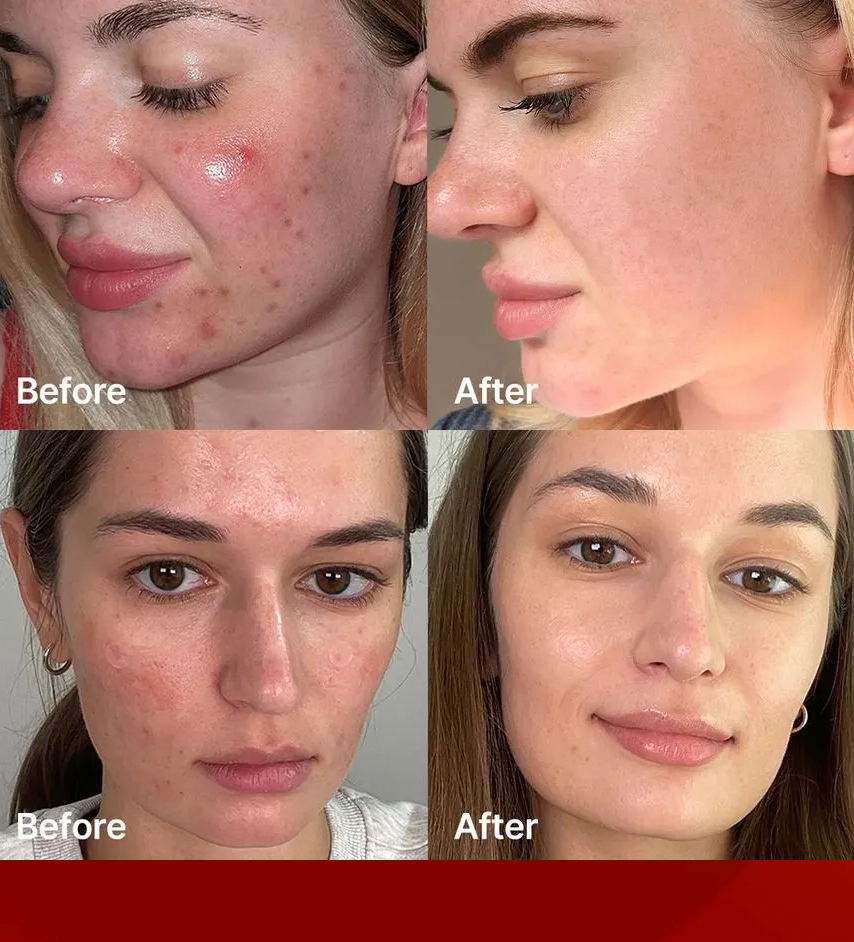 Medicube Red Succinct Acid Clarifying Serum