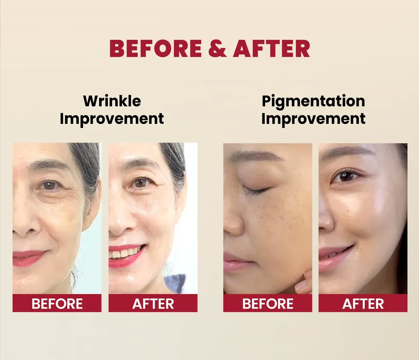 KSECRET - Sérum Facial SEOUL 1988 Serum: Retinal Liposome 2% + Black Ginseng