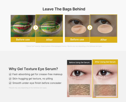MEDICUBE Acido Kojico Turmeric Vita Eye Gel Serum