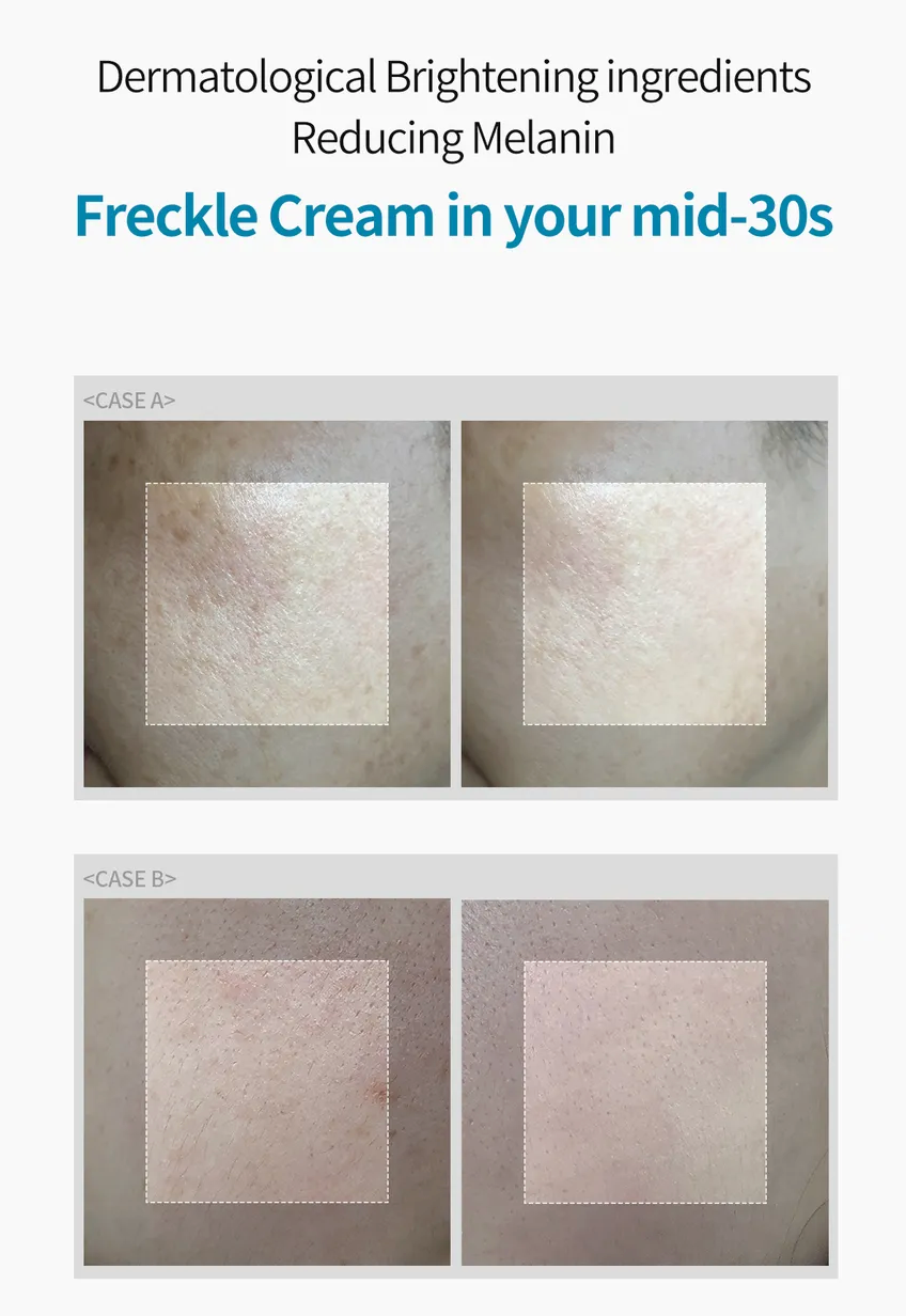 Dr. Melaxin TX Cream Tratamiento Antimanchas