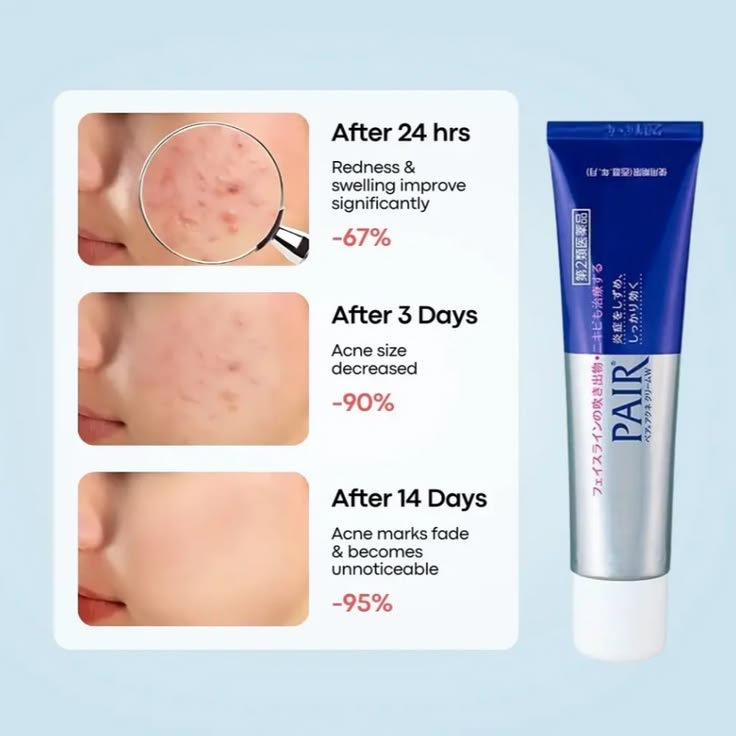 LION Pair Acne Cream 24gr.