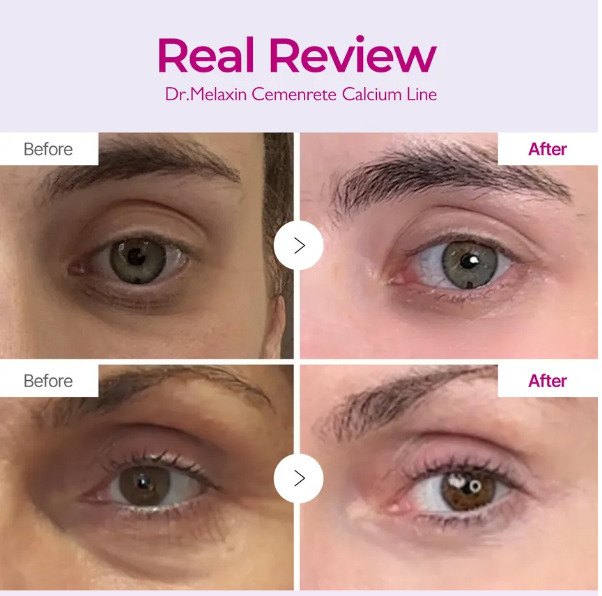 Dr. Melaxin Cemenrete Calcium Volume Cream